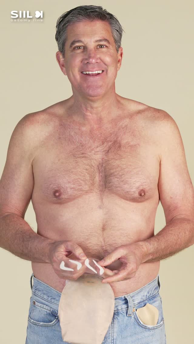 Anúncio de SIIL Ostomy