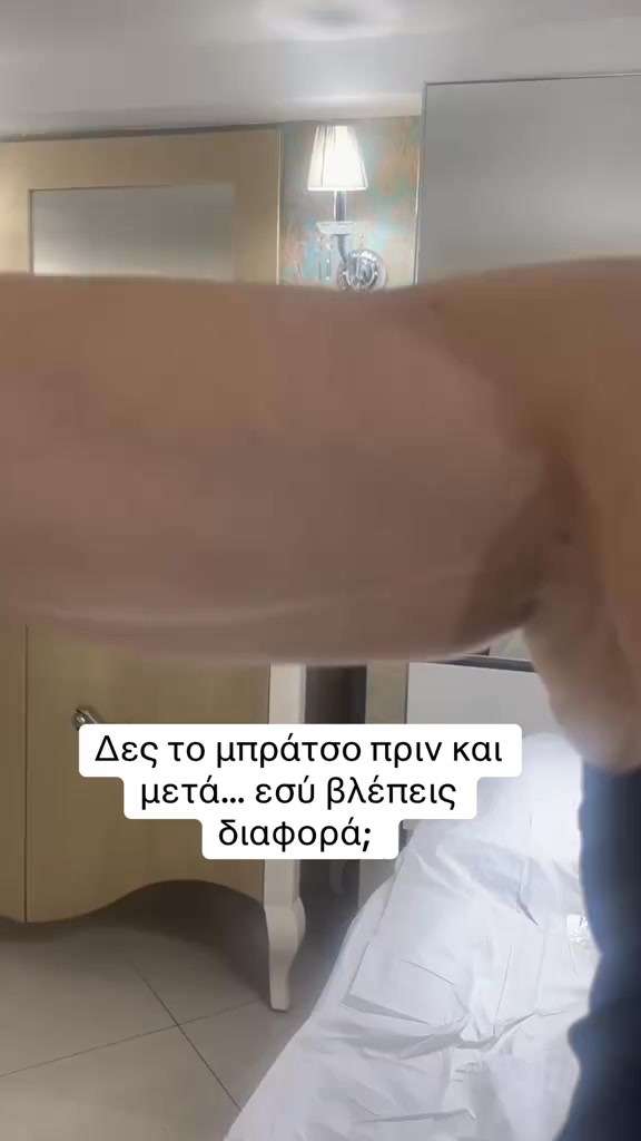 Σε ενοχλεί η χαλάρωση στο μπράτσο;