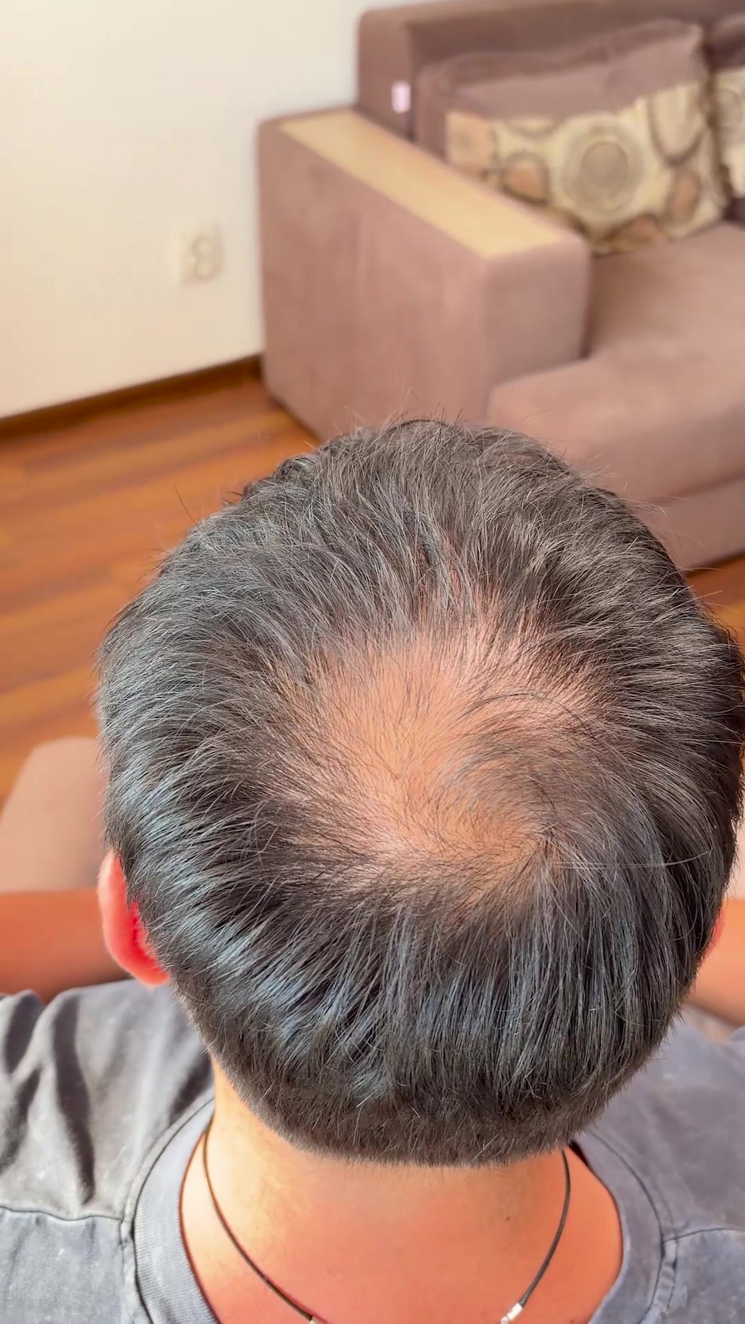 Your hair. With the gaps filled.