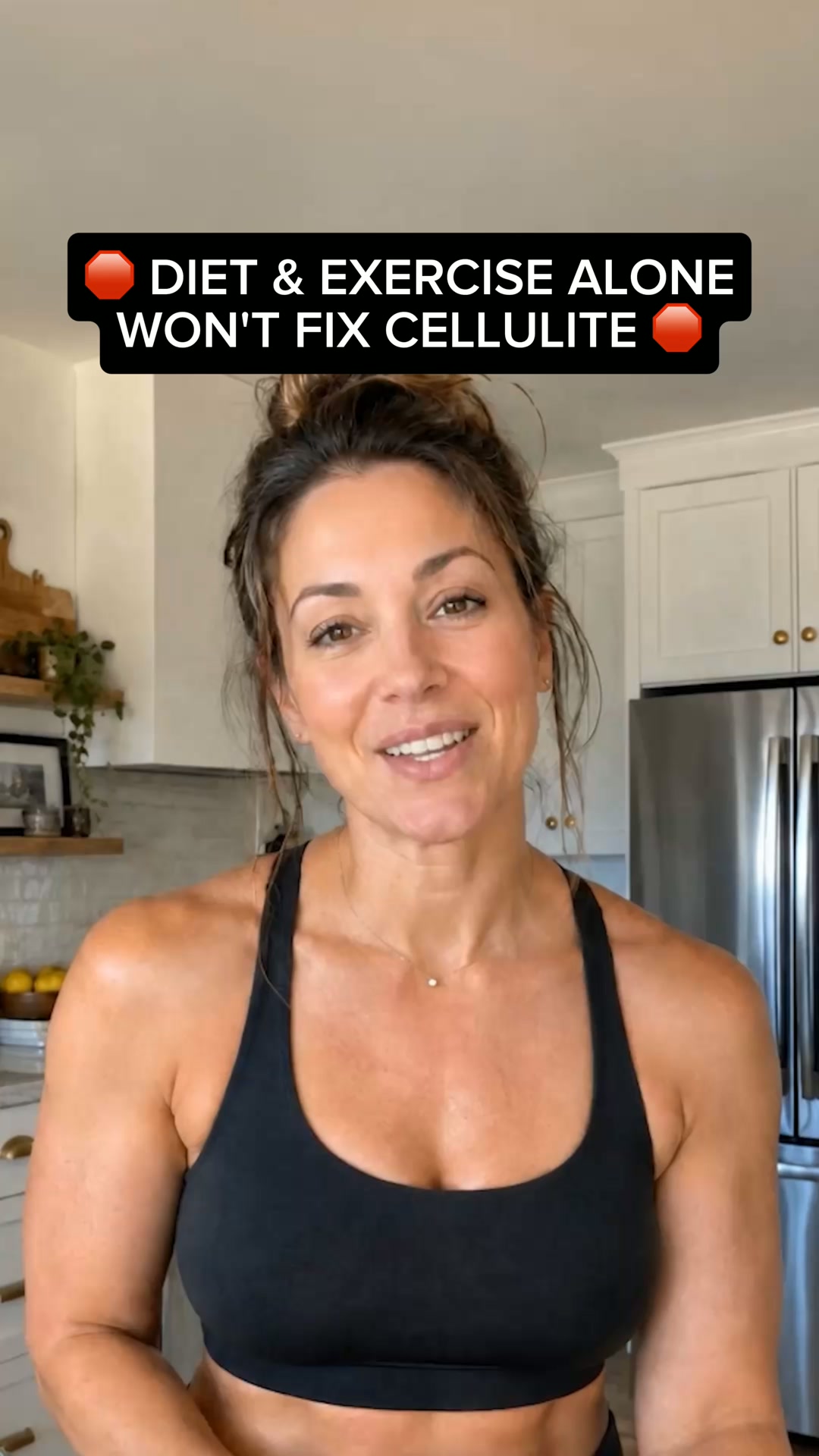 The 3 Hidden Biological Root Causes of Cellulite Revealed
