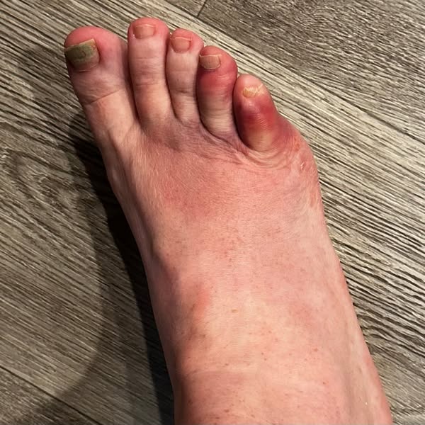 Lisez ça si la périménopause rend vos pieds douloureux au réveil