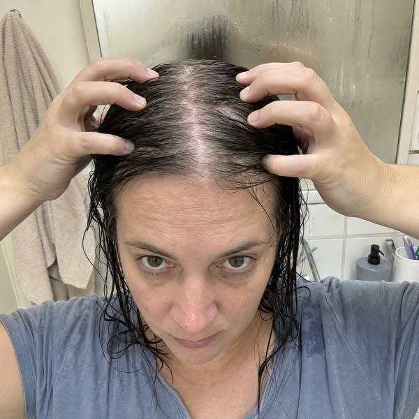 If Your Hair Is Thinning Read This