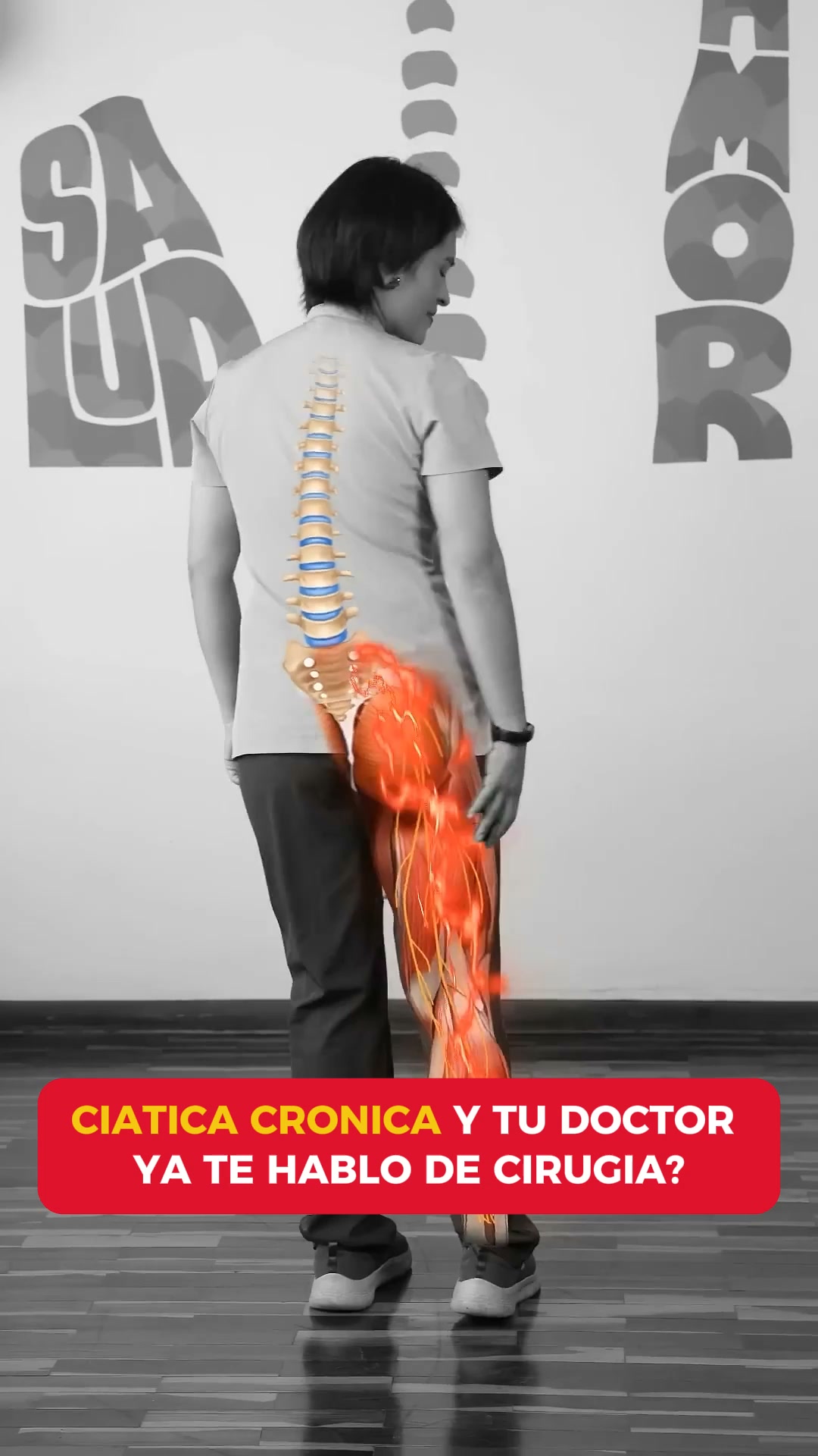3 Terapias Contra la Ciática en 1