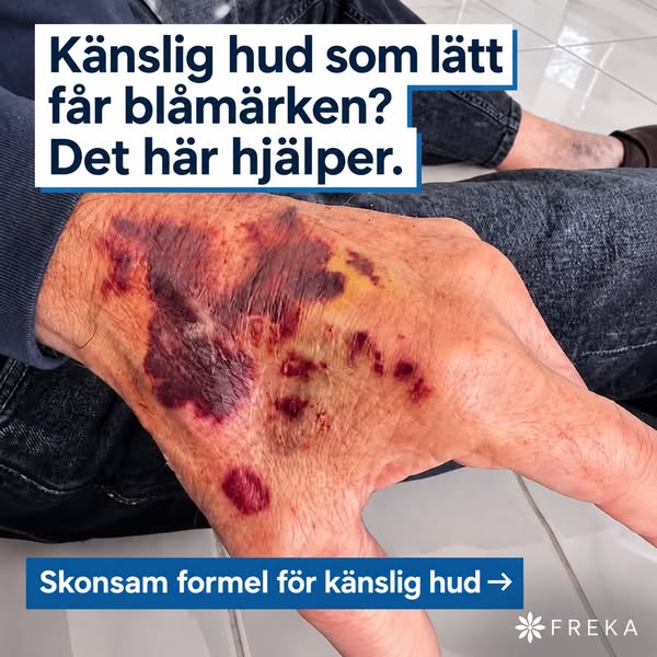 Blåmärkeskräm – Med arnica, vitamin K och ceramider