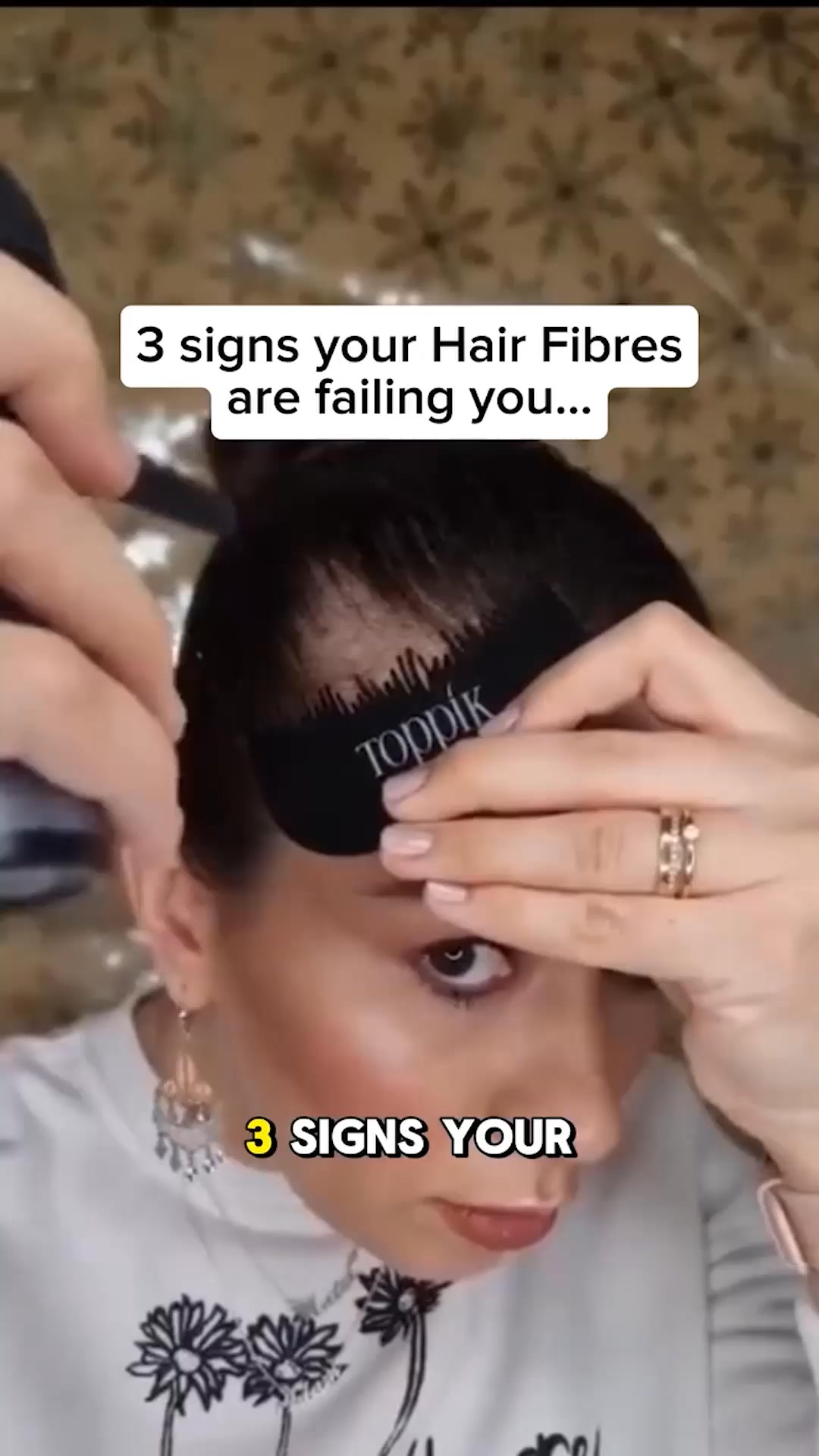 Beat Hairloss Today