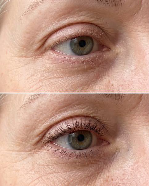 Lashes back. No prostaglandins.