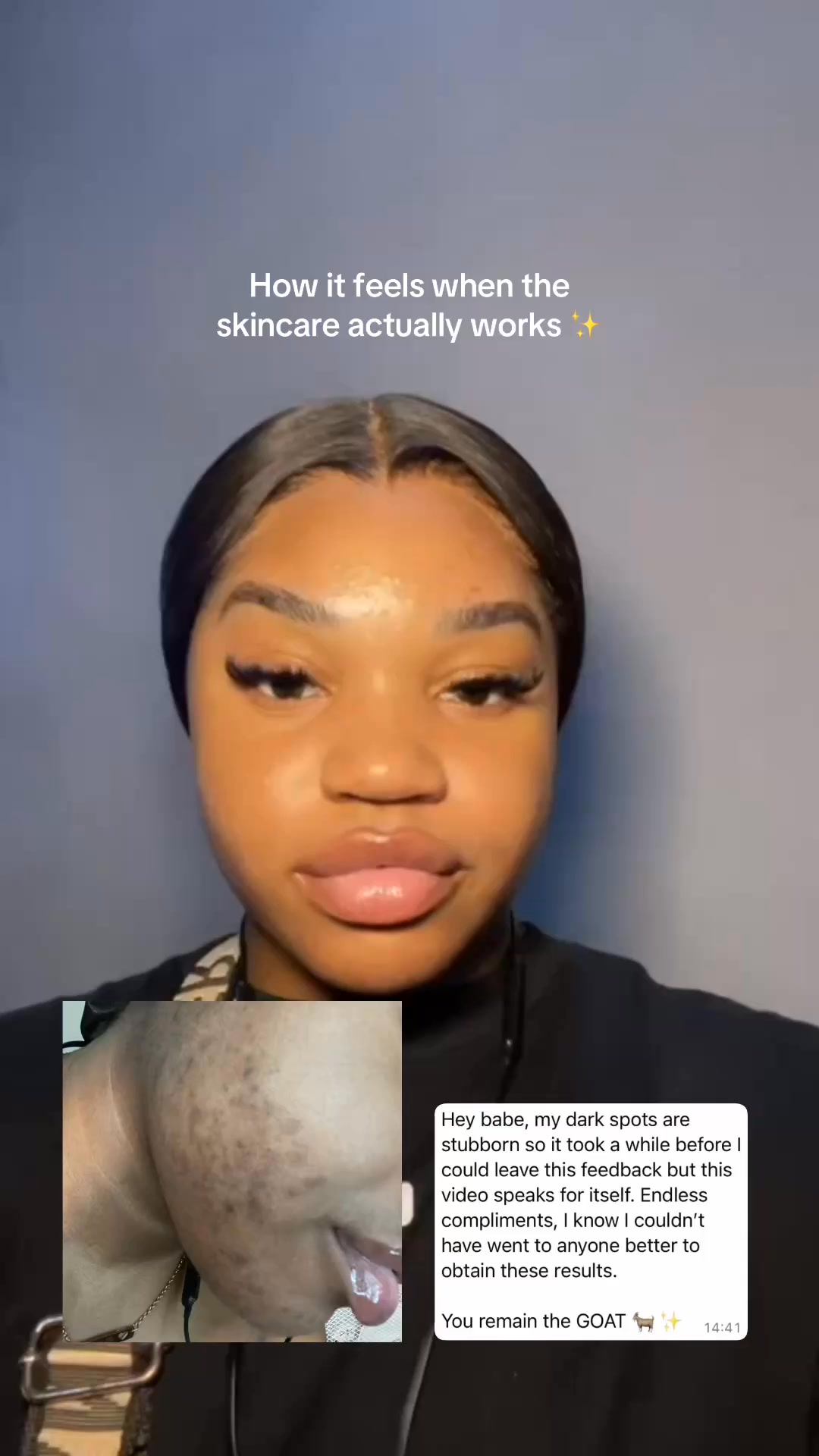 Anúncio de GS skincare