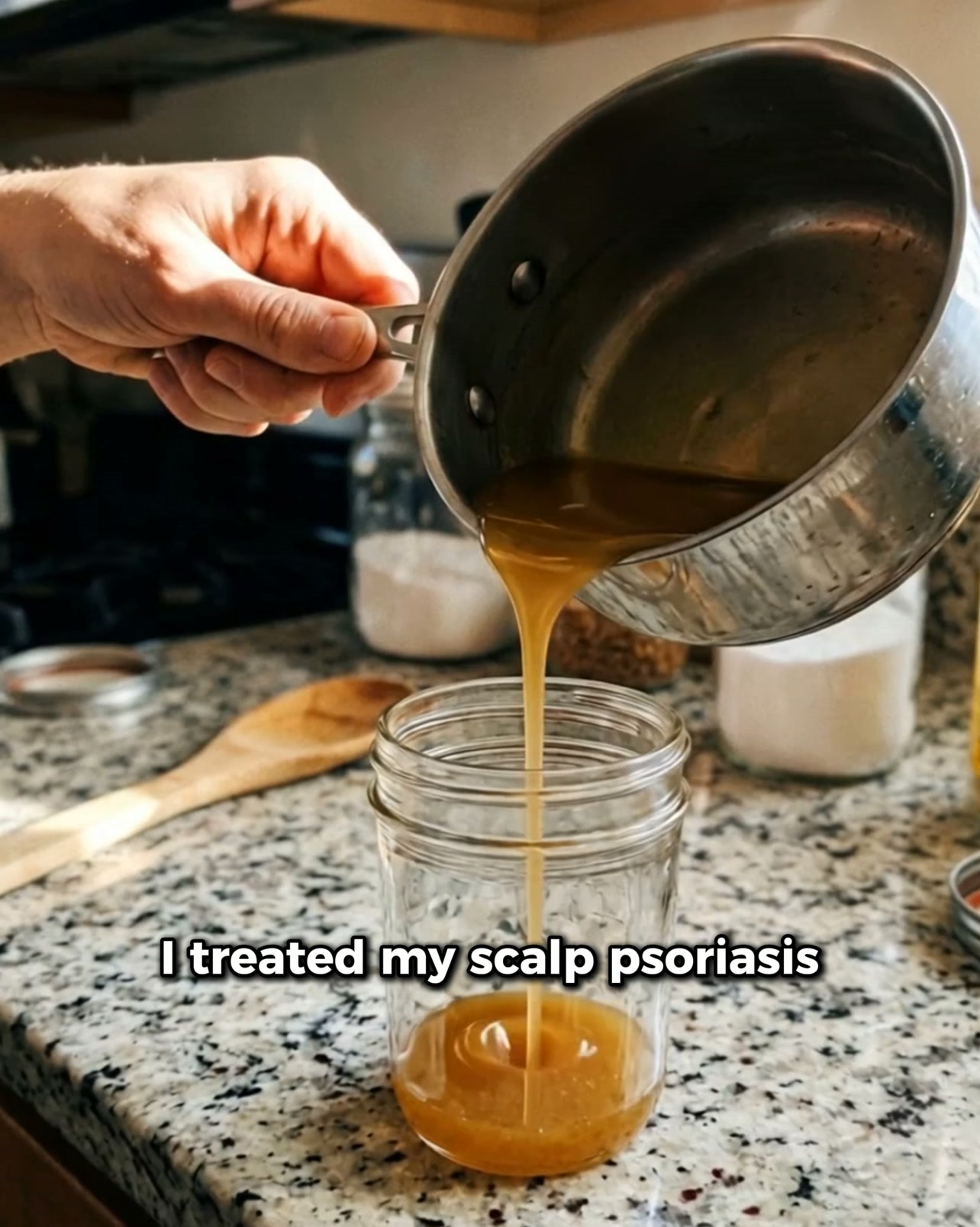 The Natural Balm Finally Ending The Itch