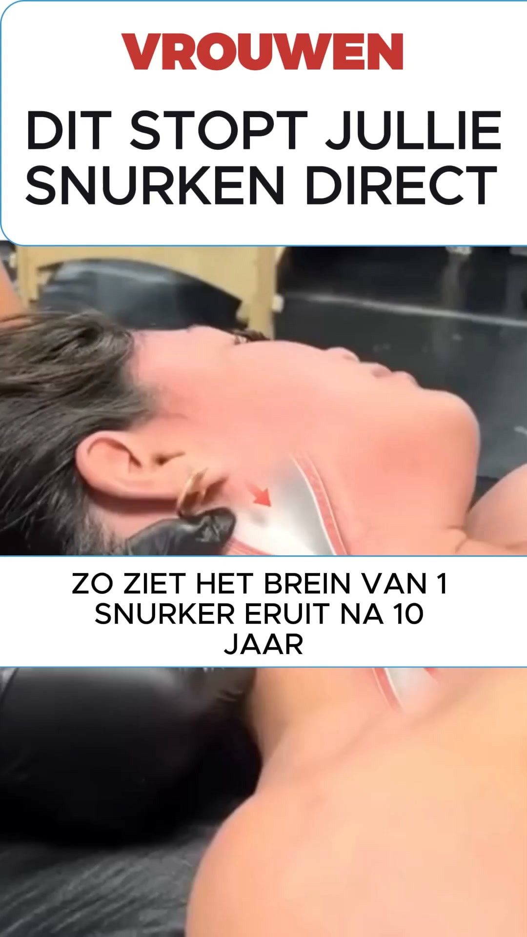 De slimmere manier om snurken te stoppen!