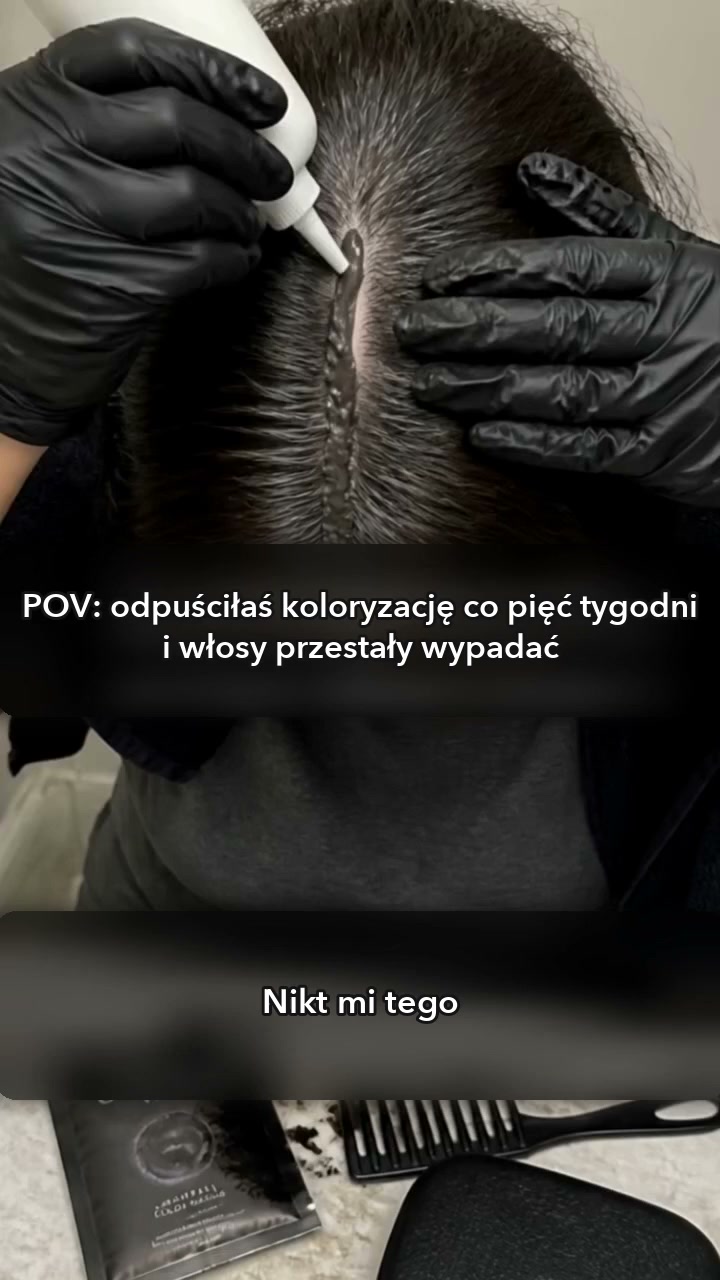 Skóra głowy to skóra. Ona to zapamiętuje