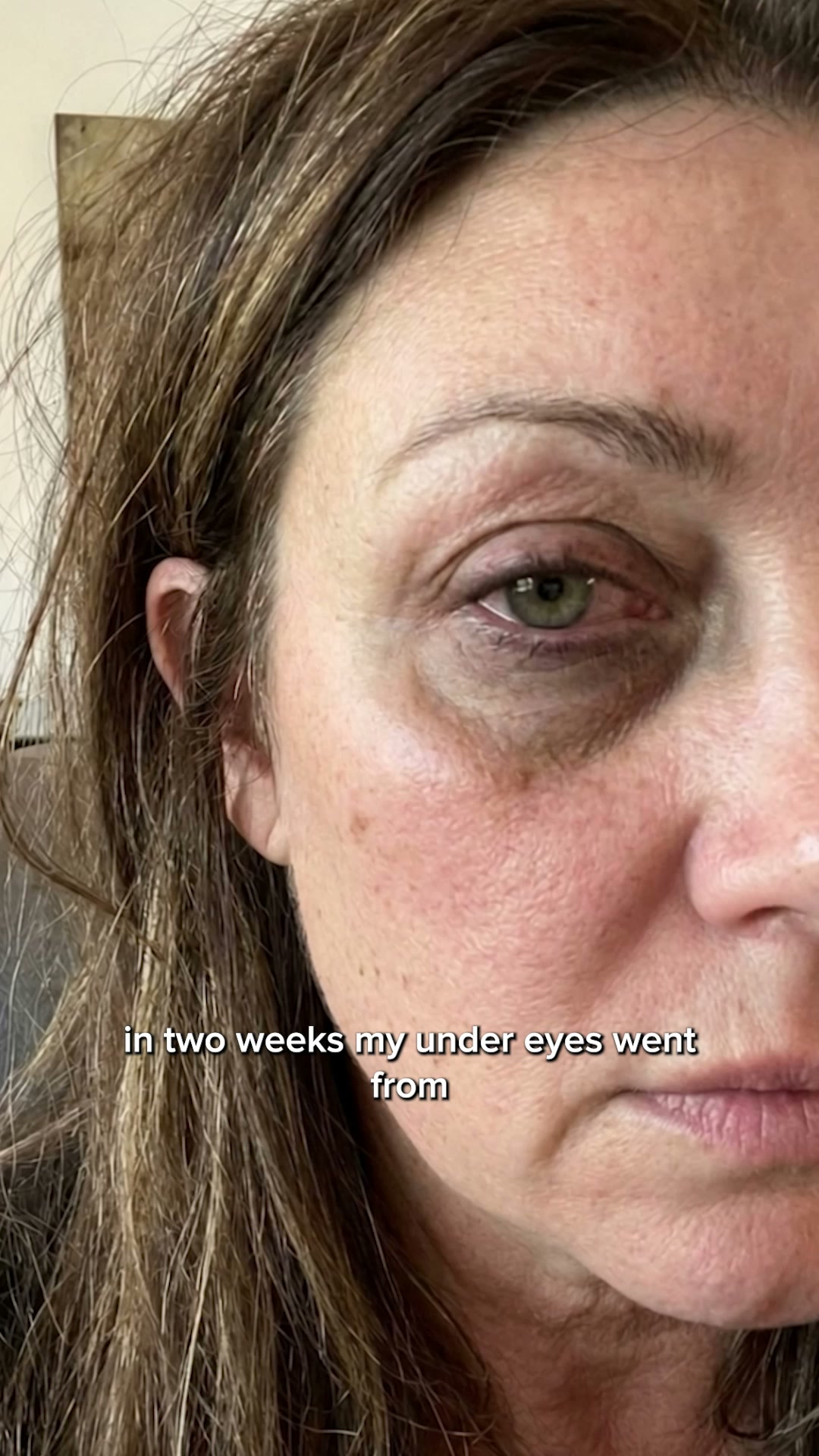 The Viral Serum That's Selling Out
