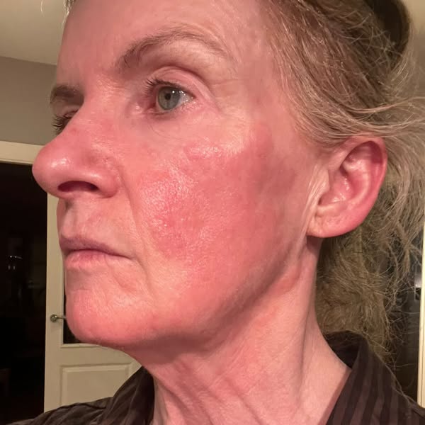 Anúncio de Bragan Skincare