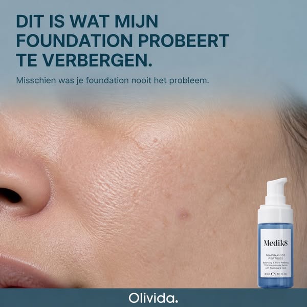 Wat eronder zit