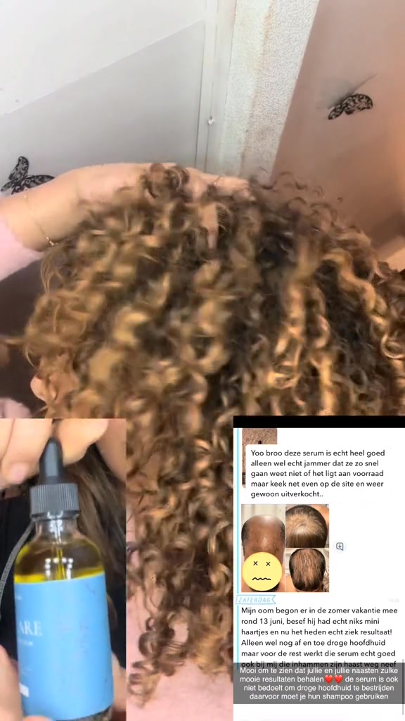 De Reviews Over Deze Serum Zijn Echt Bizar