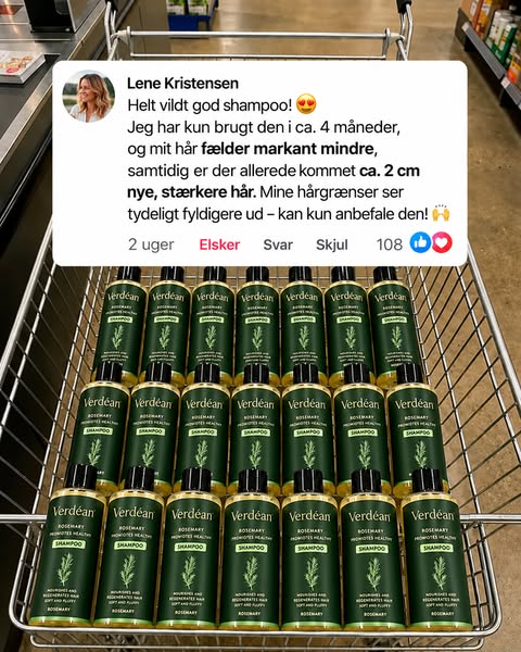 Farvel hårtab — goddag nyt hår