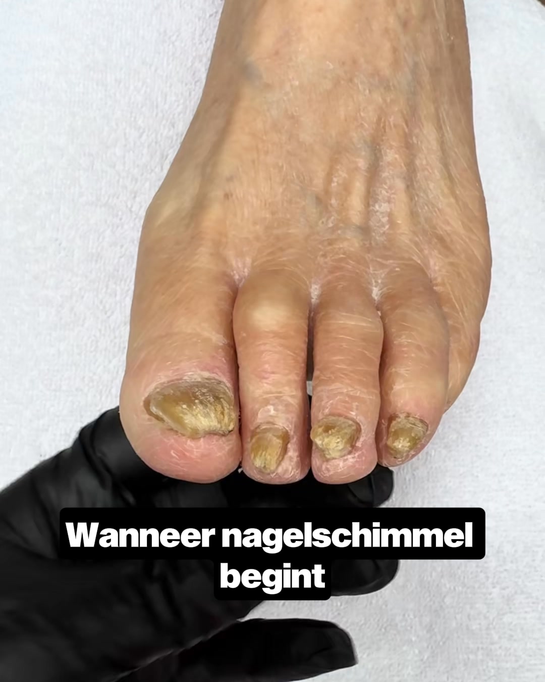 Je nagels verdienen een nieuwe start!