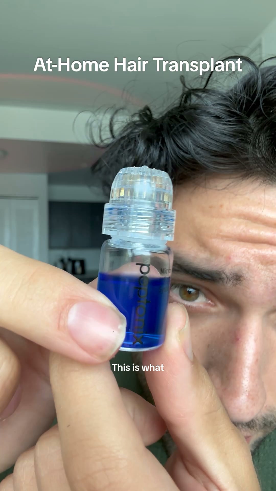 Restore Your Hair
