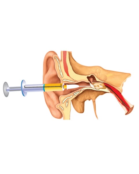 I Was Diagnosed With Vertigo At 46. I'm 58 Now. Turns Out The Dizziness Wasn't My Inner Ear.