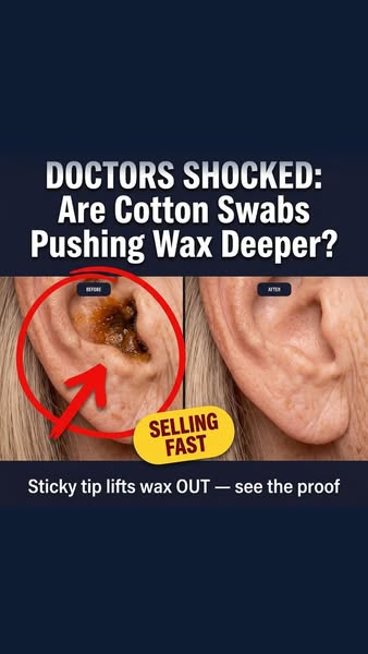 Upgrade Your Ear Cleaning