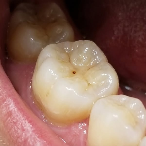 Your Teeth Can Repair Themselves. Here's How.