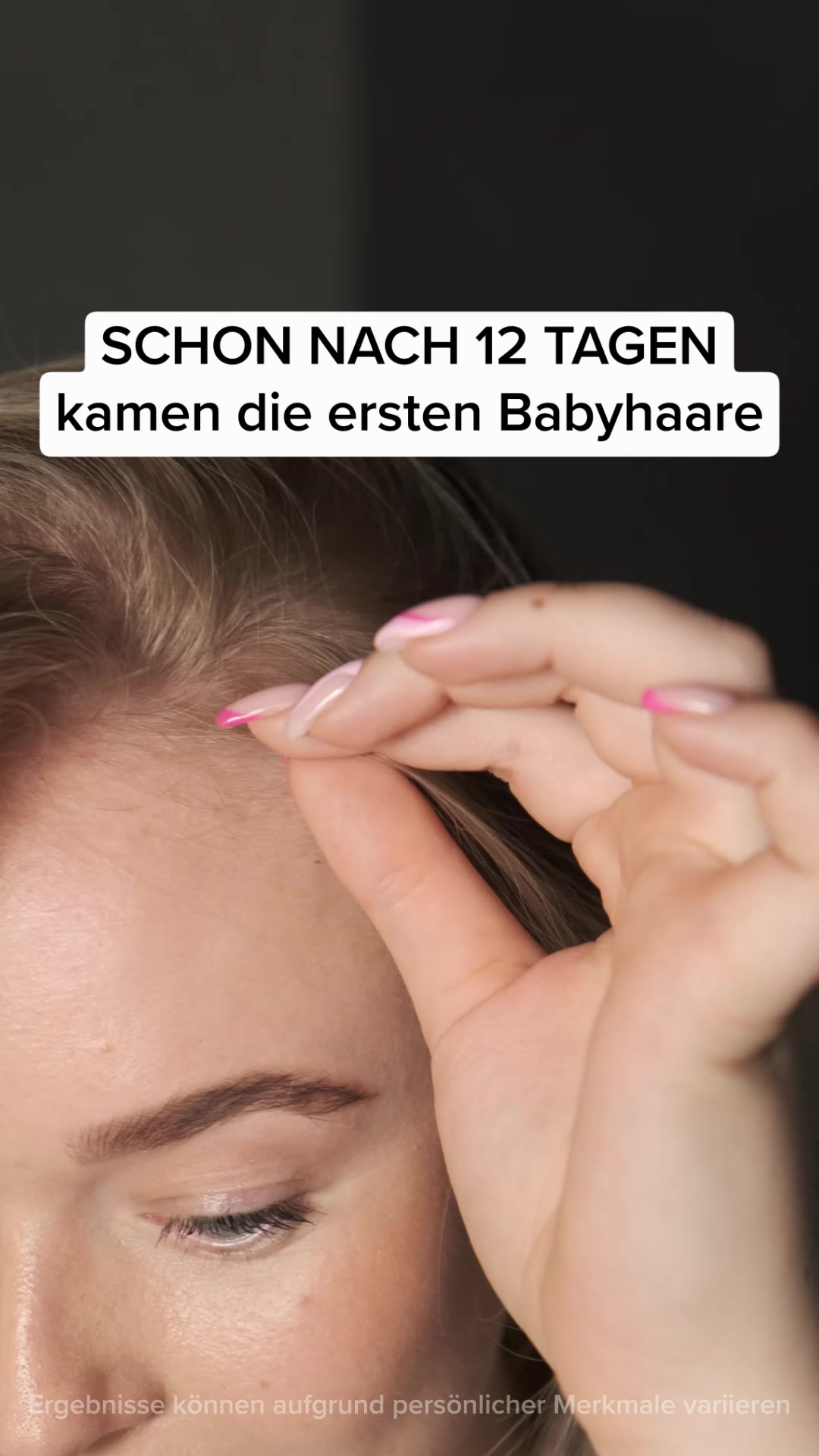 Haarwachstum anregen