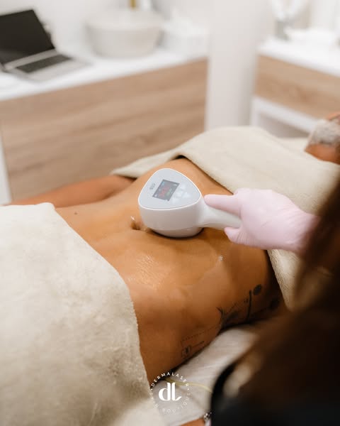 Exilis Ultra 360 | Dermalaser