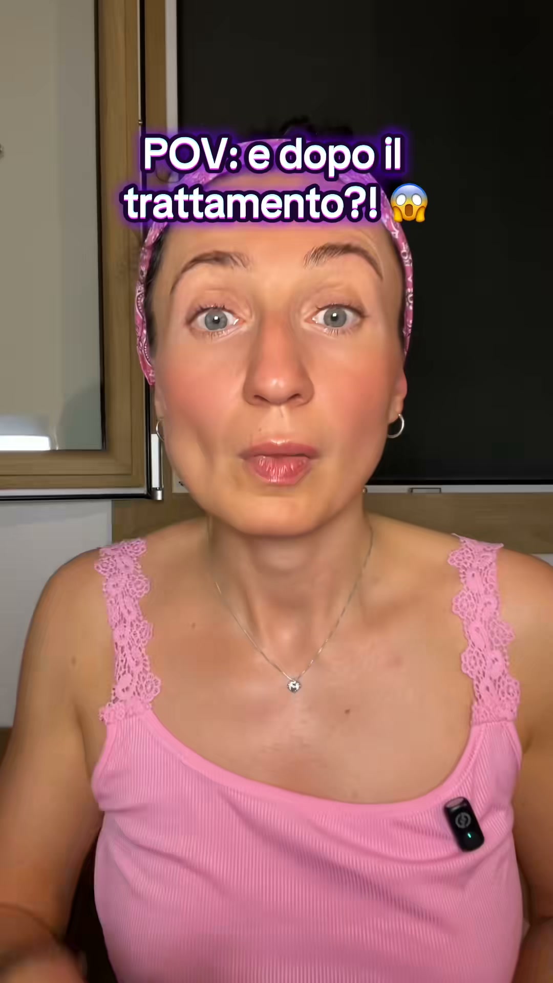 Labbra più piene? Prova questo