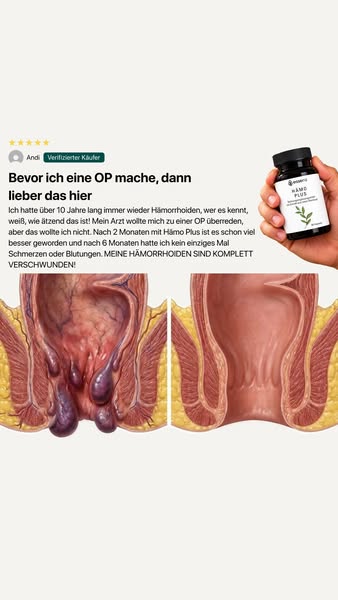 Hämorrhoiden natürlich von innen unterstützen