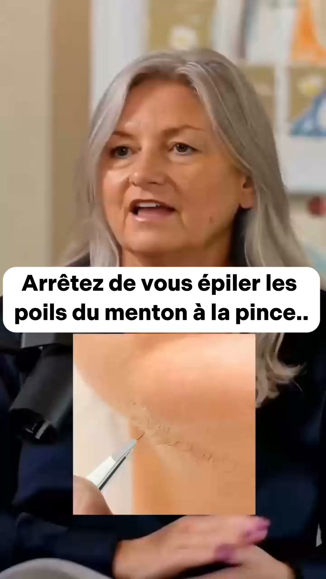 Empêchez vos poils du menton de repousser.