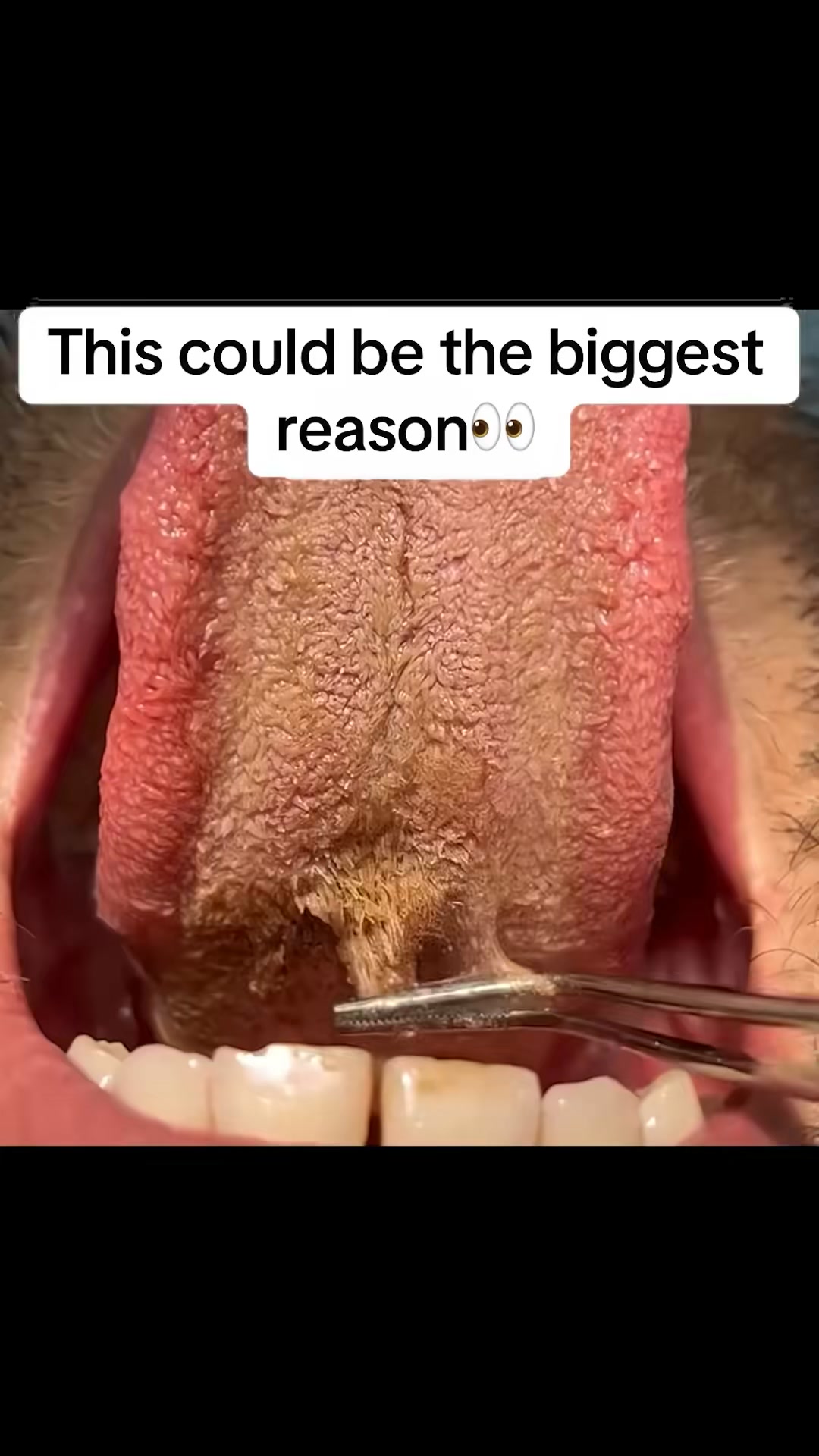 Shield Your Smile Against Daily Stains