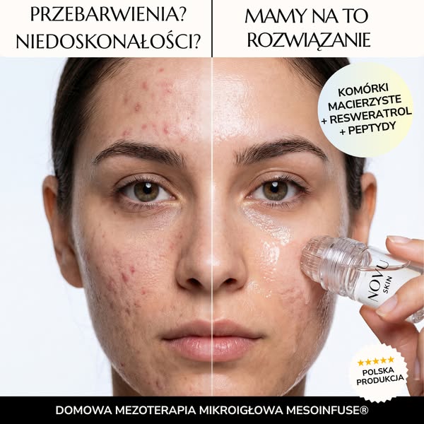 Zastrzeżona receptura MesoInfuse®