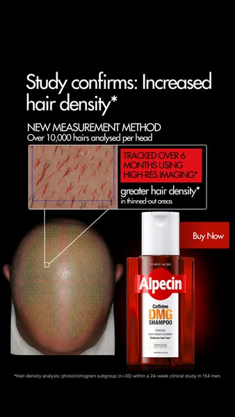 NEW: Alpecin DMG Shampoo & Serum