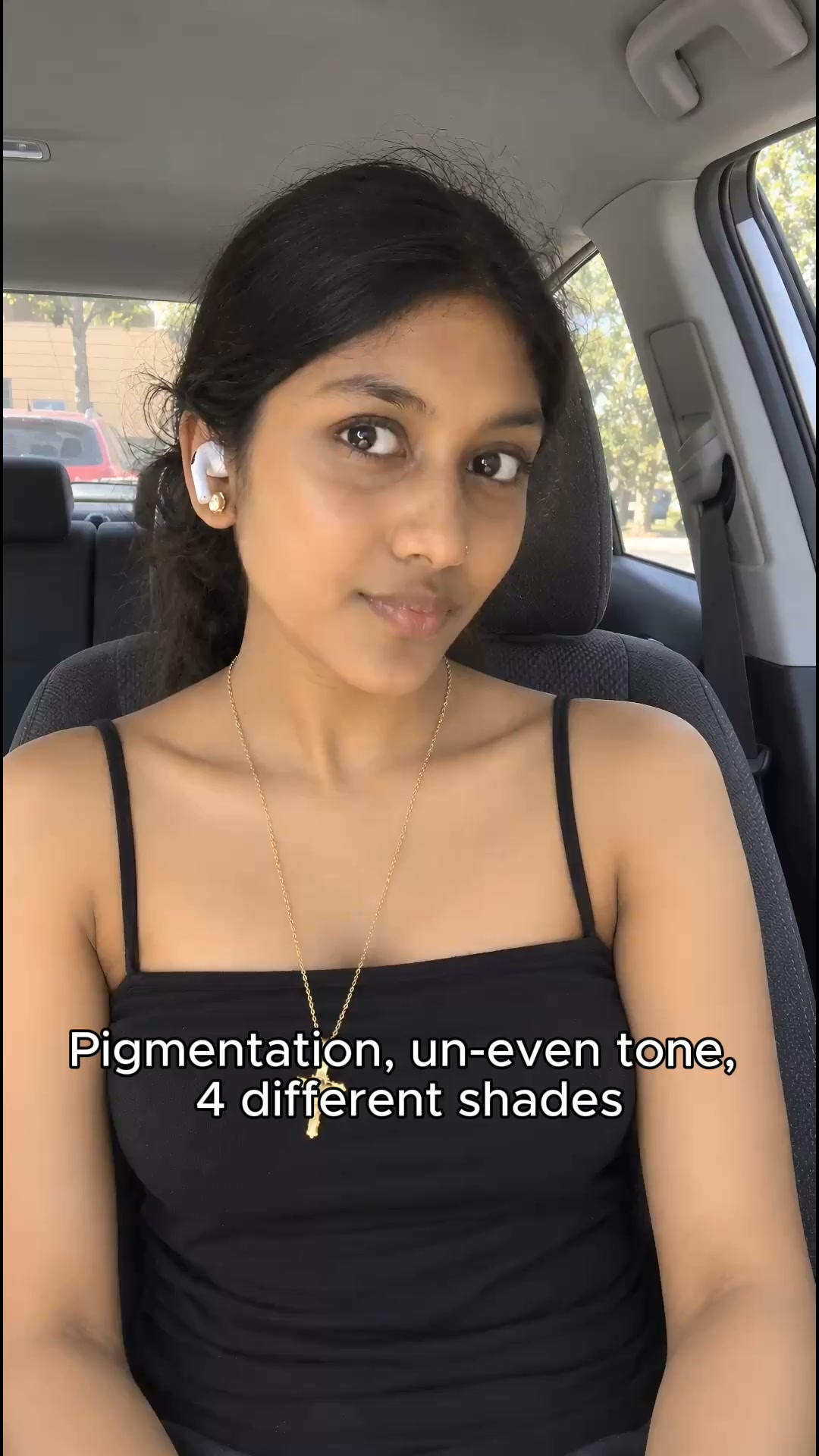 I’d Tried So Much for My Uneven Skin