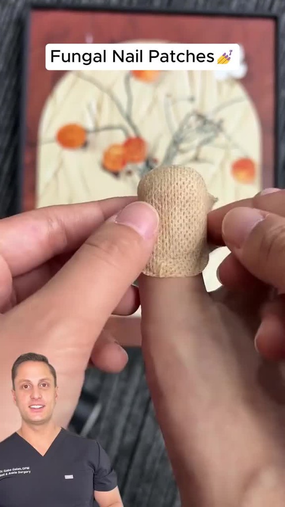 Fungal Nail Patches