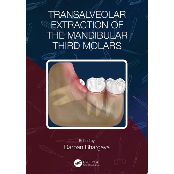 Transalveolar Extraction of the Mandibular Third Molars