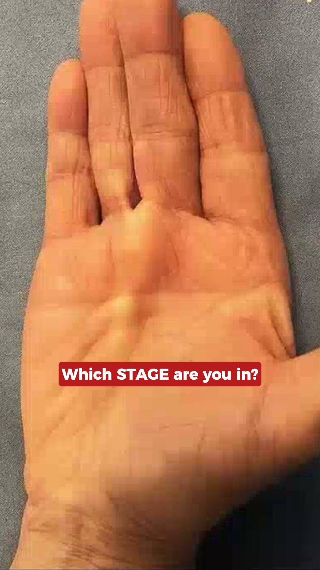 Which Stage Are You In?