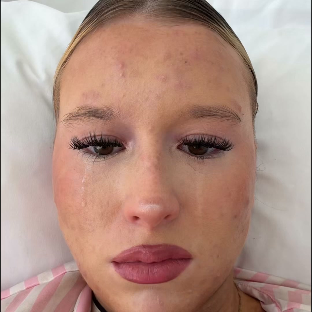 1 cream. 1 routine. Skin that finally got the message