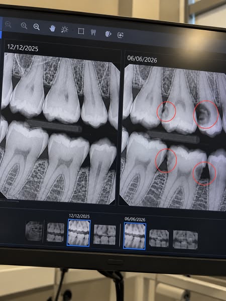 “I Finally Stopped Thinking About Food. Now I’m Thinking About Which Tooth Will Hurt.”