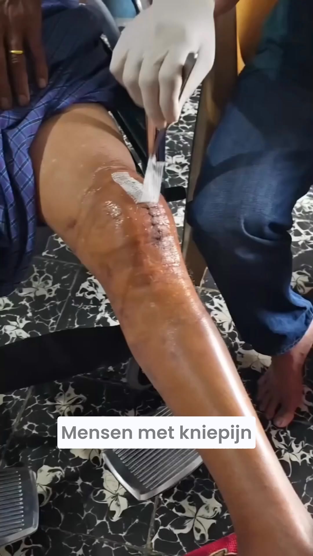 Koop 1, krijg 1 gratis