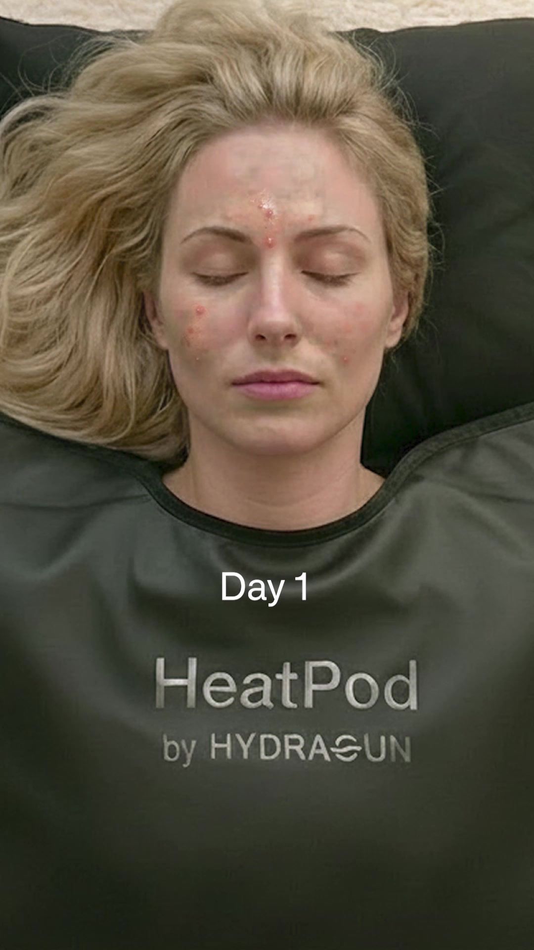 Unlocking Luminous Skin in 30 Days