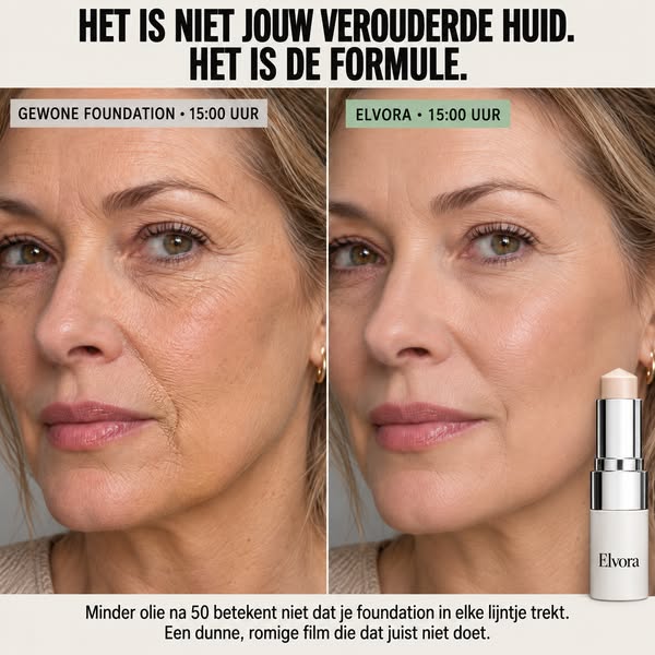 SHOP NU! Probeer hem vandaag nog zonder risico.