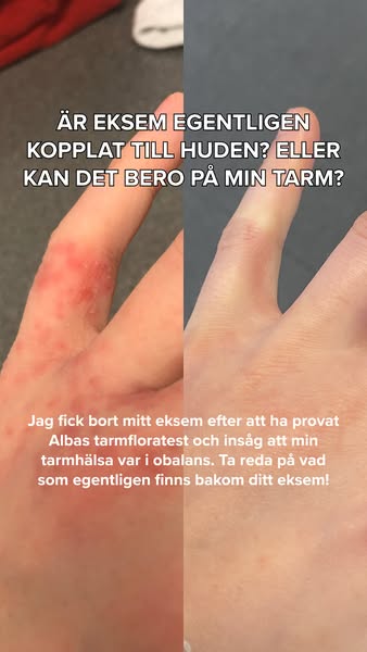Testa din tarmhälsa