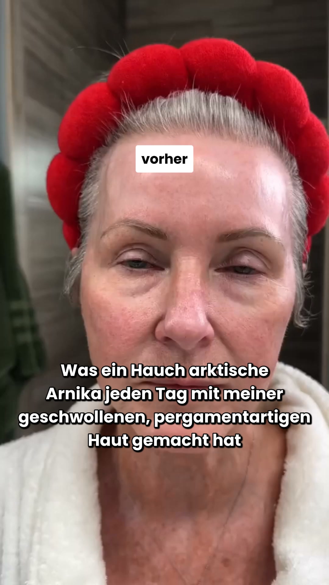 Nebenwirkung: jüngere Haut