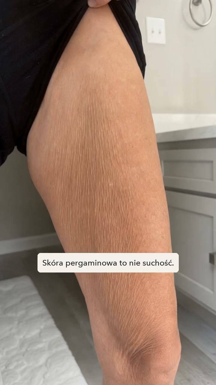 To nie suchość. To kolagen.