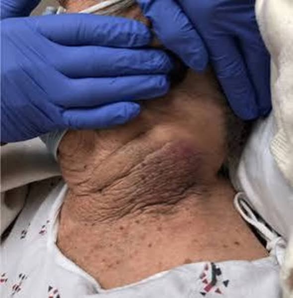 J’ai découvert pourquoi votre poids thyroïdien persiste