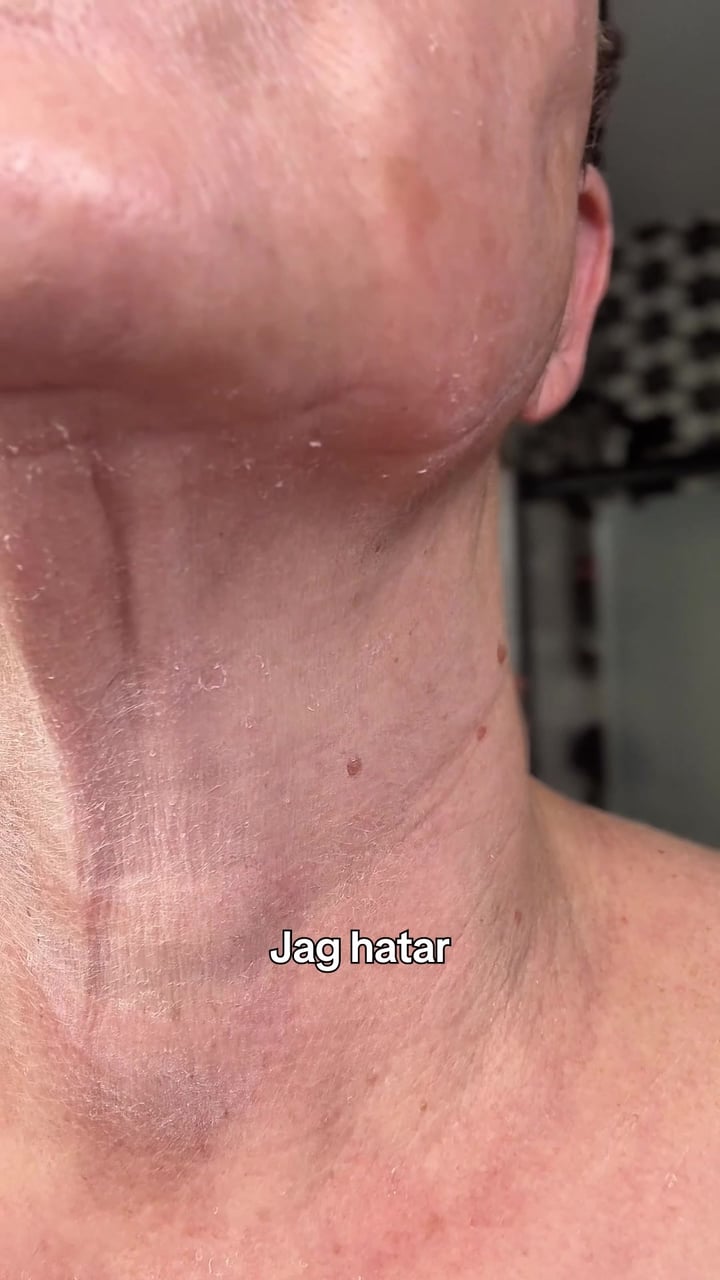 Återfå din ungdomliga skönhet