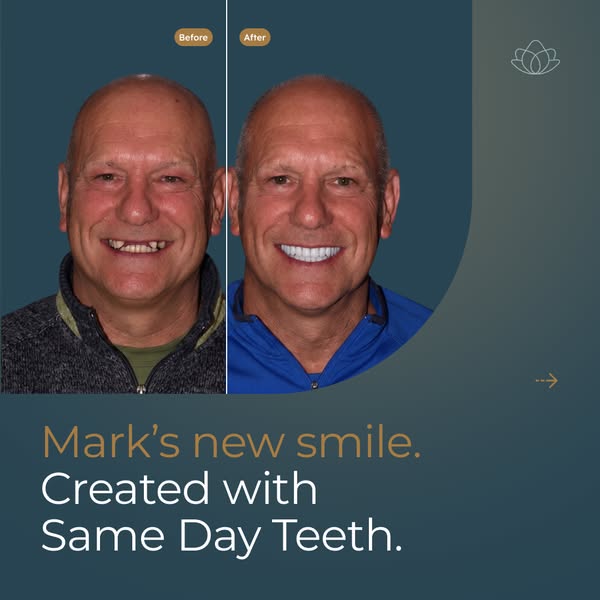 Mark's New Smile