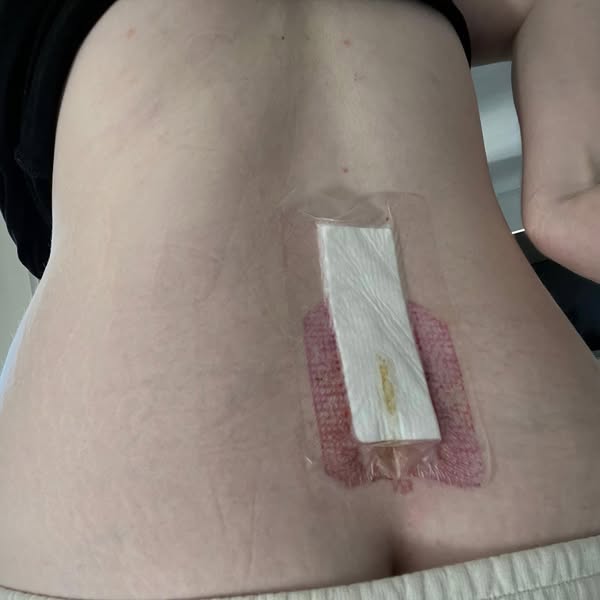 My knees had been stiff and aching for 3 years. I spent the last 8 months rubbing on pain-relief gels every night with zero results. What I’