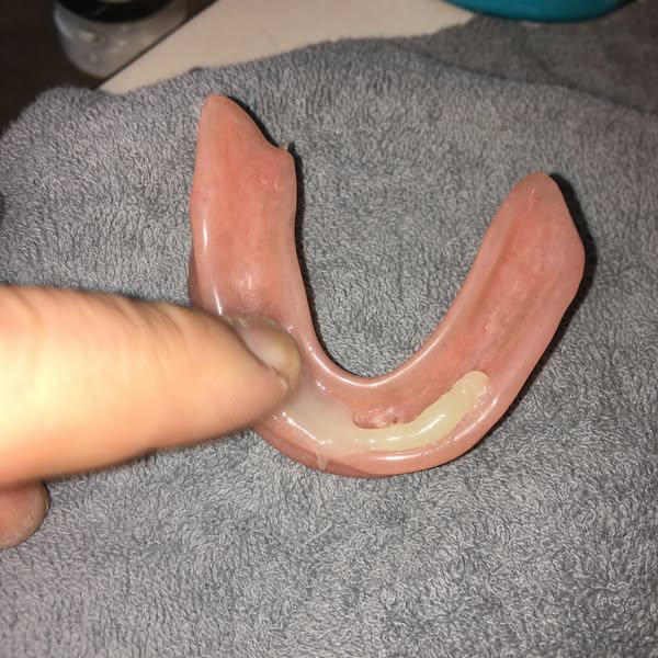Read this if you wear dentures