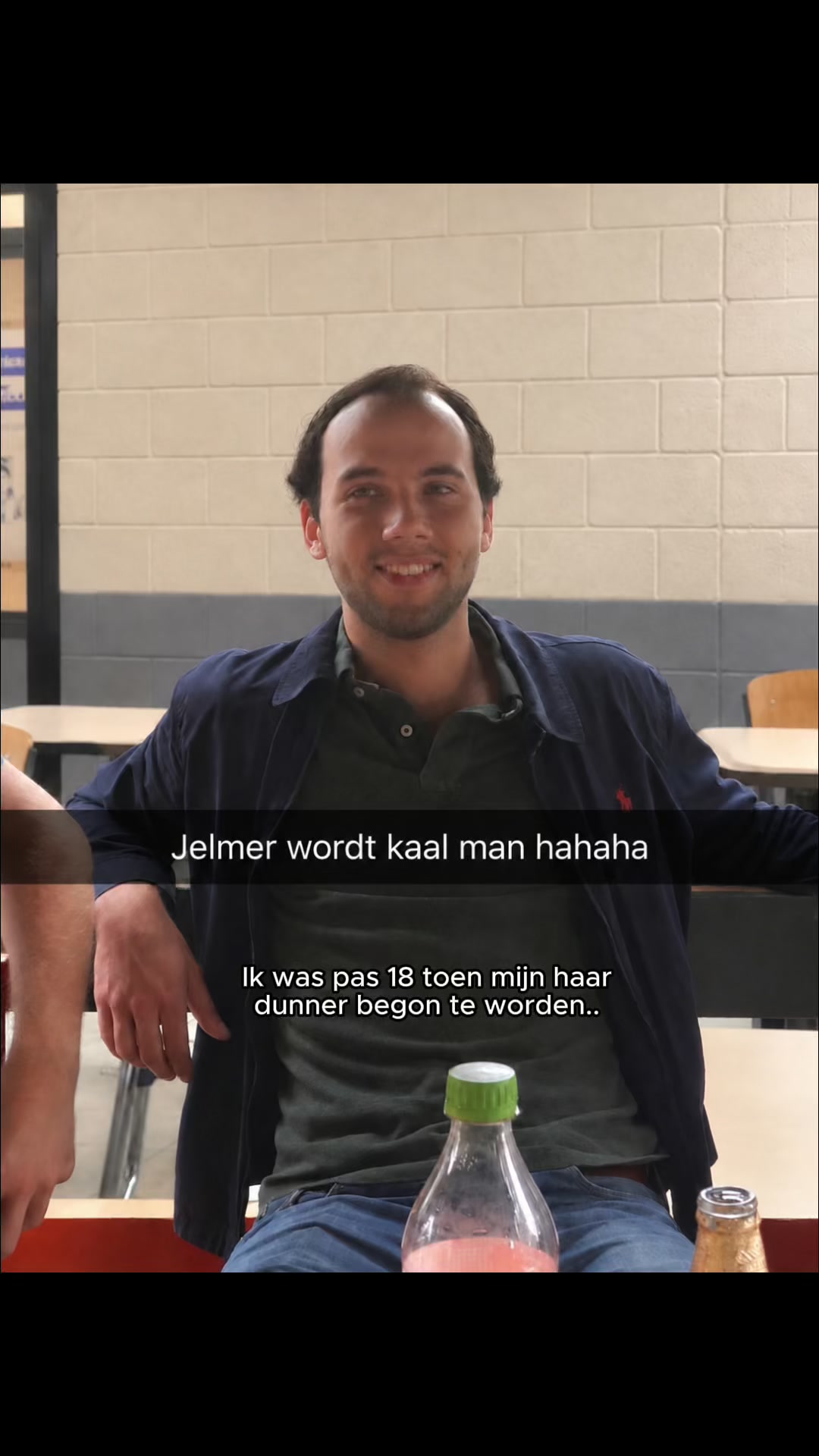 Kaal op je 18e, dit is wat hielp